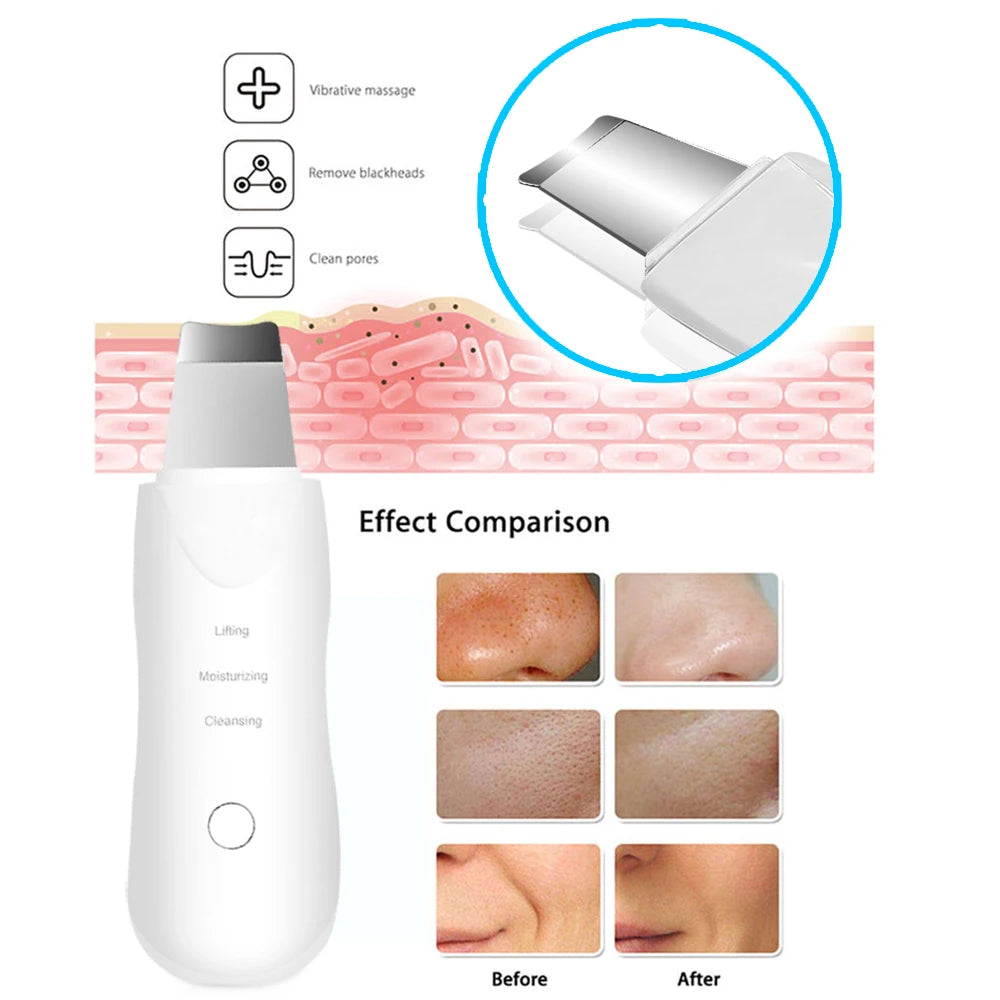 Ultrasonic Deep Vibrate Skin Scrubber