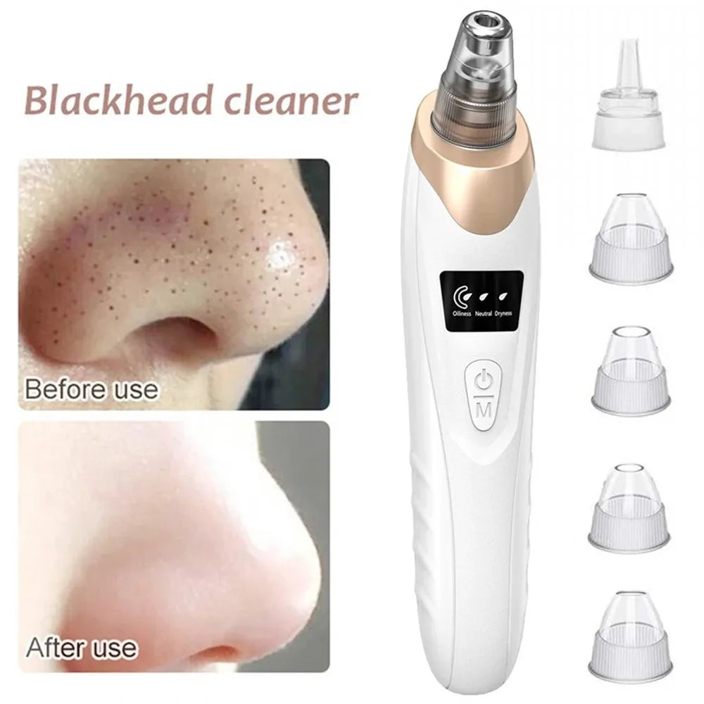 Electric Blackhead Remover Vacuum Cleaner