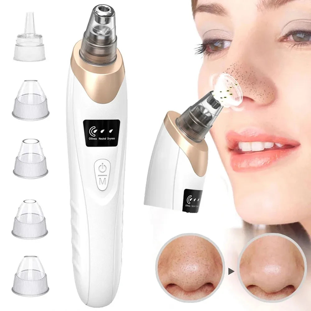 Electric Blackhead Remover Vacuum Cleaner